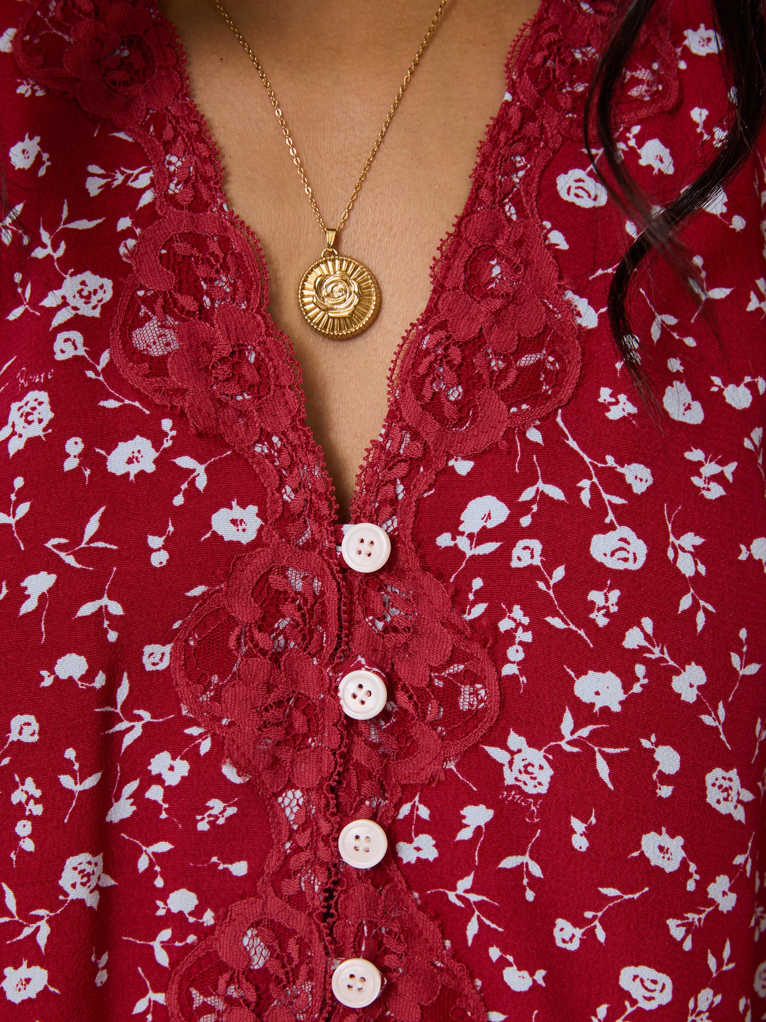 ALDA Top